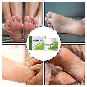 Crème durée pour les pieds | Crème durée à résistance maximale 42% pour les pieds | Gel dissolvant pour les pieds calleux, 