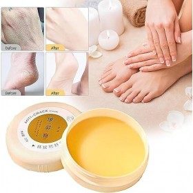 Lot de 2 crèmes anti-craquelures naturelles pour lhiver - Crème anti-gel apaisante et réparatrice de la peau craquelée - Crè