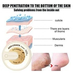 Crème&nbsp;Anti-déchirure&nbsp;pour&nbsp;Peau&nbsp;dhiver, Crème Anti-Crevasses Talons, Crèmes Pour Pieds, Baume Pieds Secs, Creme Pieds Tres Se