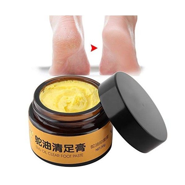 Huile De Soin Des Pieds Creme Antifongique Traitement Champignon Pied Champignon Ongle Pied,crème De Massage Antifongique Enl