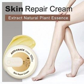 Cracked Skin Repair Cream, Winter 2022cracked Skin Repair Cream,anti Crack&hand Foot Cream, Cracking Cream 15g, Heel Cracked 