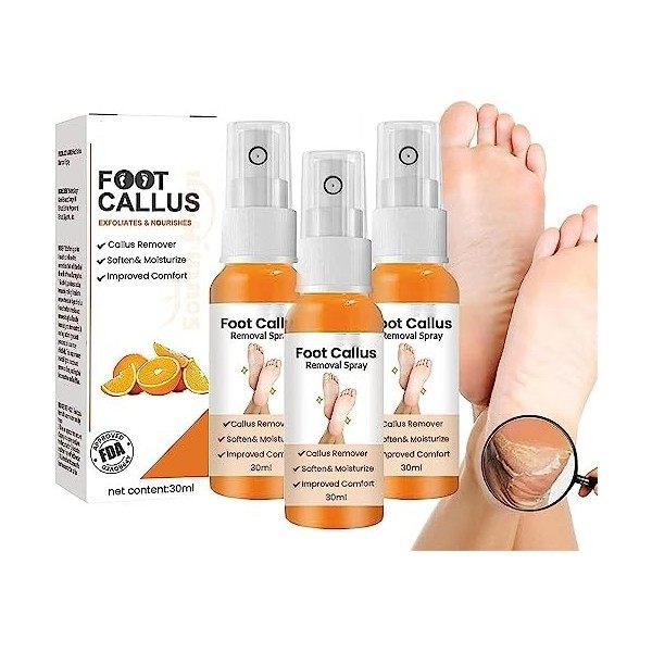 EXQST Spray Anti-callosités des Pieds, Spray adoucissant Les callosités des Pieds, Spray exfoliant pour Les Pieds, élimine Ra