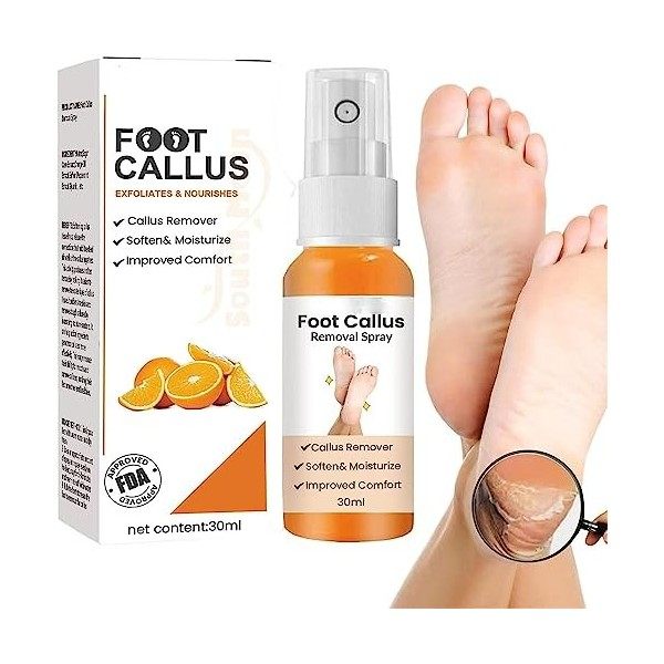 EXQST Spray Anti-callosités des Pieds, Spray adoucissant Les callosités des Pieds, Spray exfoliant pour Les Pieds, élimine Ra