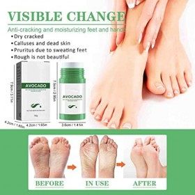 Felee BâTon De Lotion à LAvocat RéSistant Aux Fissures,BâTon Hydratant Les Pieds,CrèMe Anti-Fissures Et Mains Et Pieds,BâTon
