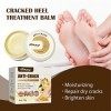 Crème Réparatrice Pour Les Pieds - Crème Pour Les Pieds Anti-fissures,Crèmes Pieds Anti-Crevasses,Crème Pour Les Pieds Anti-f