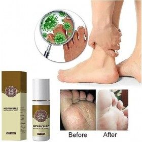 Umeloeo Spray de traitement antifongique, anti-fongique, des champignons, champignons pieds, pieds pour athlètes