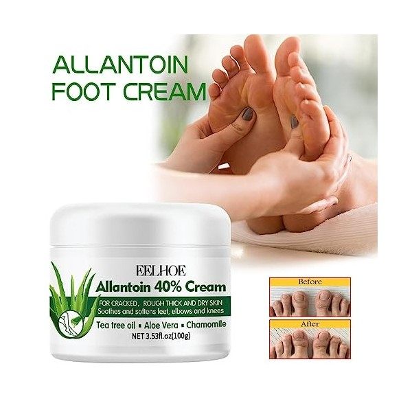 Soin des Pieds Crème Hydratante | Crème Hydratante Healthy Feet Soin Peau Sèche Crème Nourrissante Hydratation Profonde,Lotio