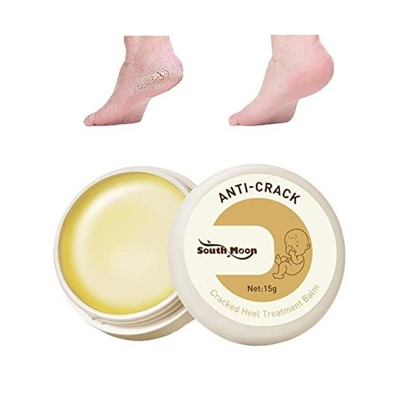 Mandeep Crème pour Les Pieds Crevasses Crème pour Les Pieds Très Secs et Callosités Crème Réparatrice Pieds Crème Pieds Hydra