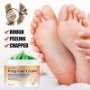 Crème Pour Les Pieds Sec, Réparation De Talon, Crème Exfoliante Pied Soin Des Pieds, Anti Engelures Sec Fissures Crème