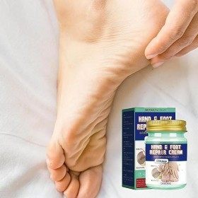 Crème Réparatrice Mains Et Pieds | Crème Peeling Mains Pieds, Soins des Pieds | Produit pour talon craquelé pour peau extrême