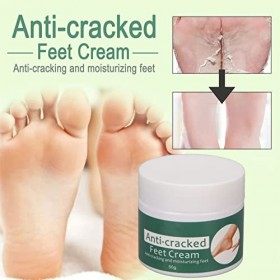 Baume RéParateur pour Talons CrevasséS, CrèMe RéParatrice pour les Fissures du Talon, RéParation de la Peau Morte, CrèMe de S