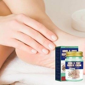 Crème Pieds Pour Talons Fissurés Secs,Soin des pieds, produit talon fissuré | Soin des pieds, guérit et hydrate pour des pied