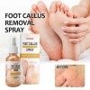 Foot Peeling Spray | Réparation Main Pied Se Soucier Exfoliant Crème Anti Engelures Sec Fissures Et Fissures | Instant Foot P