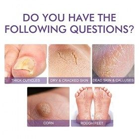 Soin des pieds à la lavande Hydrate et hydrate le pied Nettoie les coins, les fissures sèches et nourrit la peau morte Soin d