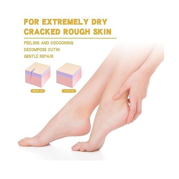 Ditanpu Talons craquelés,Crème Talons Fissurés | Baume pour Les Pieds aux extraits naturels de, Hydrate Les Pieds pour Les Pi