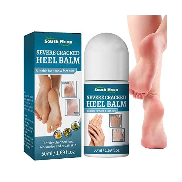 Cyhamse Baume Réparateur Talons Fissurés - Crème réparatrice pour Les Pieds gravement fissurés,Crème de réparation des Pieds 