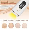 Starensky éPilateur Lumiere PulséE, LumièRe PulséE Intense Ipl LumièRe PulséE éPilation Petit Et Portable Ipl Hair Removal, p