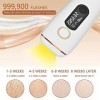 Starensky Kit DéPilation Au Laser, 5e Intensité Lumineuse Epilation Visage éPilation Definitive Machine Laser Epilation, pou