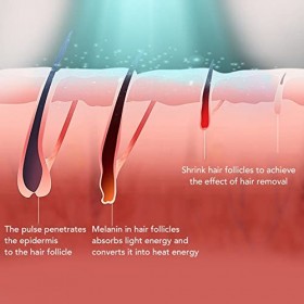 Appareil DéPilation IPL, éPilation IPL 990000 Flashs Refroidissement de la Peau 100-240V éCran LCD à LarrièRe Prise UE