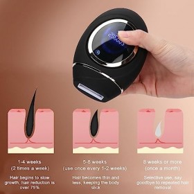 Machine dépilation, épilateur électrique à lueur automatique 5 vitesses réglable contrôle tactile intelligent pour bras pour