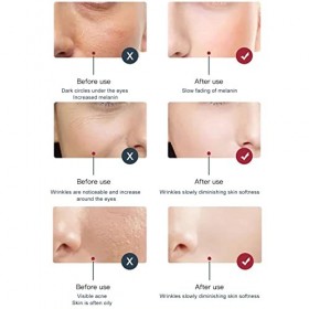 Machine de beauté Faciale de Photon, Appareil de beauté Facial Pliable de Photon Réutilisable Réglable pour le Salon de beaut