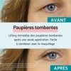 Remescar Paupières Tombantes Crème Yeux 8ml - Affaissement des Paupières - Cliniquement Éprouvé Pour Lanti-vieillissement - 