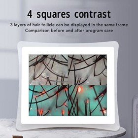 Uxsiya Détecteur de Cuir chevelu et de Poils de Peau, détecteur de Peau de follicule pileux grossissement 50X 200X 3 Modes d