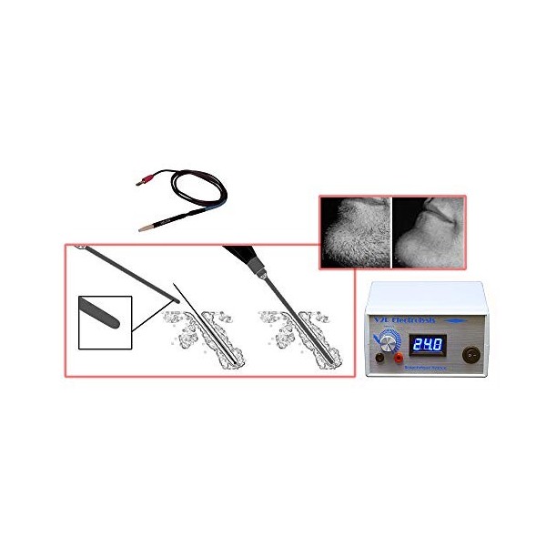 V2R galvanische Elektrolyse Dauerhafte Haarentfernung Ausrüstung 2 Jahre Garantie.
