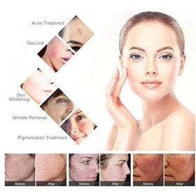 Générique Machine dépilation IPL Bureau Opt SHR Soins de la Peau blanchissant linstrument de beauté de rajeunissement de la