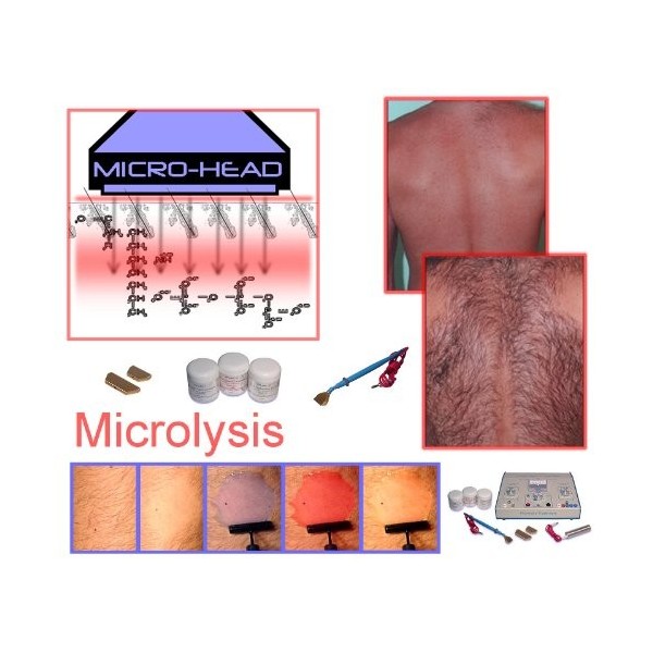 Aavexx Micro 1000 Microlyse pour la thérapie GenenTherapy pour lépilation permanente