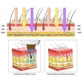 Appareil dépilation de bureau à fil professionnel pour épilation du visage, des jambes et des bras, bikini zone