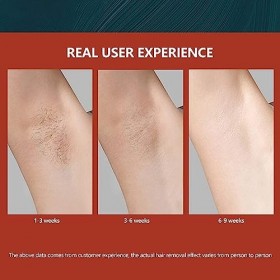 Épilation 808 nm, machine dépilation 808 durable, rapide, professionnelle permanente pour membres pour salon de beauté, mach