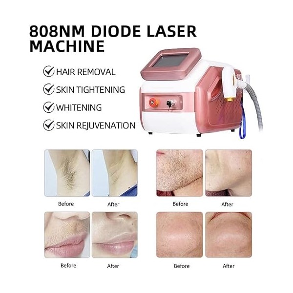 Appareil dépilation laser Ipl pour le visage - Appareil de beauté laser permanent indolore et anti-âge - Pour homme et femme