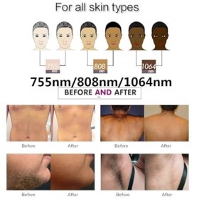 GURSAC Machine professionnelle dépilation pour raffermir la peau, épilateur haute intensité, spa, usage domestique, 20 milli