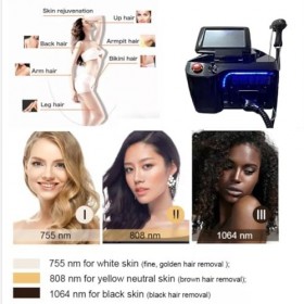 GURSAC Appareil dépilation indolore pour rajeunissement de la peau 808 nm pour jambes zone sensible du corps 3 longueurs do