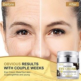 Crème contour des yeux pour les poches sous les yeux - Crème anti-âge, cernes, gonflements, crème efficace sous les yeux pour