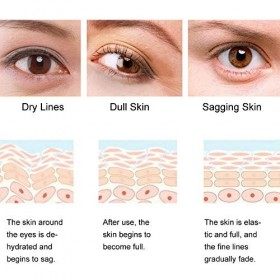 masque de soin diaderma pour les yeux, Rotekt 140g 80Pcs Patch doeil hydratant à losmanthus - Masque de soin des yeux pour 