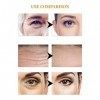 Patch contour des yeux hydratant pour les cernes,Eye Cover Nutrition Patchs hydratants pour la peau des yeux | Lot de 10 patc