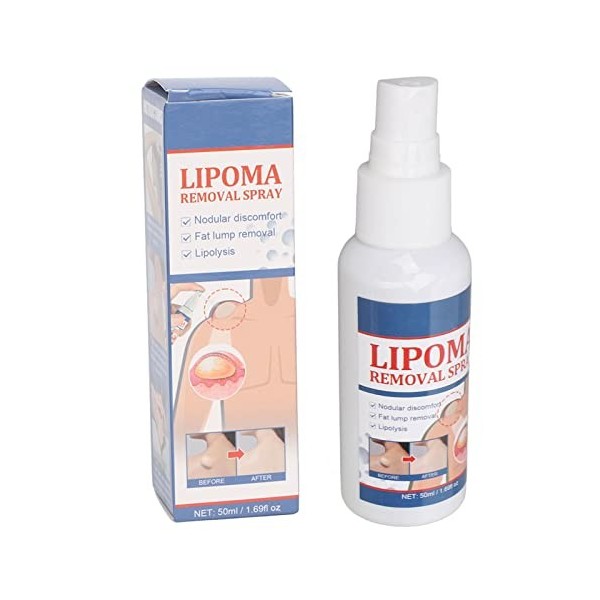 YEmirth 50ml Dissolvant De Grumeaux De Lipome Réduire la Douleur Dissolvant De Soulagement De Graisse De Lipolyse Indolore à 