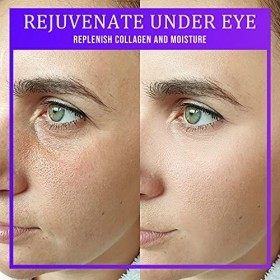 W BEAUTY 30 paires Hydrogel Masque Yeux Collagène, patch yeux pour lhydratation, les poches, les cernes et les poches sous l