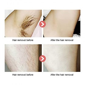 Machine Dépilation électrique, Dispositif Dépilation Portable à 5 Vitesses Permanent Indolore pour un Usage Domestique de T