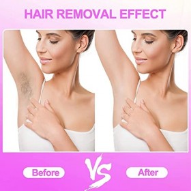 Épilation IPL, 5 Niveaux de Puissance 999 900 Flashs 100-240 V Système dépilation IPL de Haute qualité, 2 Bras Prise UE 