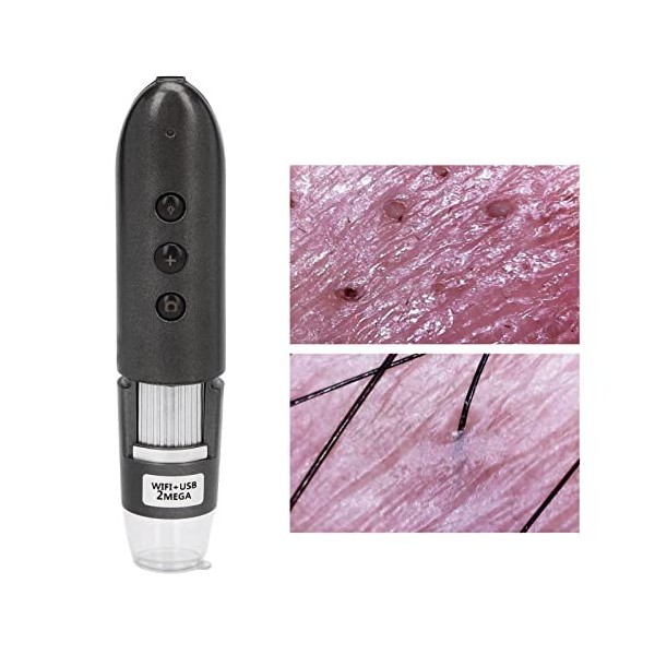 Diagnostic de la Peau Analyseur de Cheveux Grossissement 200X Détecteur de Cuir Chevelu 2MP Wifi USB Microscope Numérique Hau