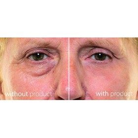 My Perfect Eyes 200 Applications