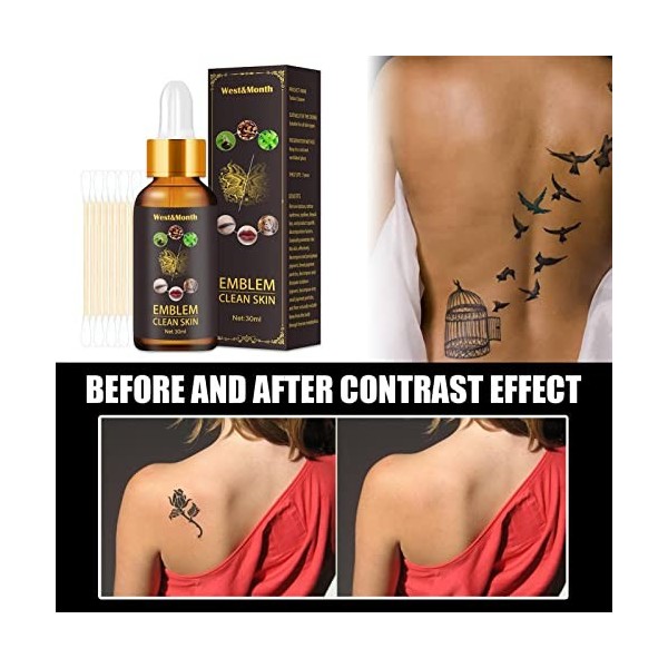 qingfeitai Crème Tatouage | Supprimer Le Tatouage - Système fondu Tatouage pour Aider à enlever Les Tatouages du Corps, kit R