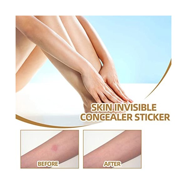 XiaoXIN 60 patchs cicatrice tatouage échaudure Silicone couvrant Patch peau Invisible correcteur autocollant respirant confor