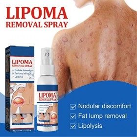 Spray Délimination des Lipomes de 50 Ml, Spray Délimination des Grumeaux de Lipomes à Base de Plantes Naturelles, Traitemen