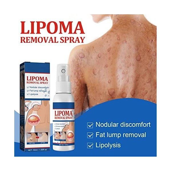 Spray Délimination des Lipomes de 50 Ml, Spray Délimination des Grumeaux de Lipomes à Base de Plantes Naturelles, Traitemen