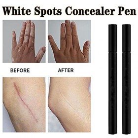 ABchat Concealer Pen, White Spots Concealer Pen Waterproof Long Lasting Vitiligo Scars Birthmarks Cover Pencil Natural Camouf