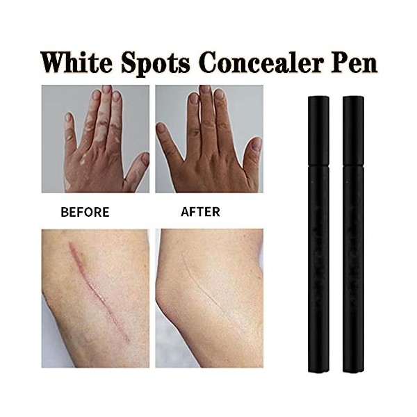 ABchat Concealer Pen, White Spots Concealer Pen Waterproof Long Lasting Vitiligo Scars Birthmarks Cover Pencil Natural Camouf